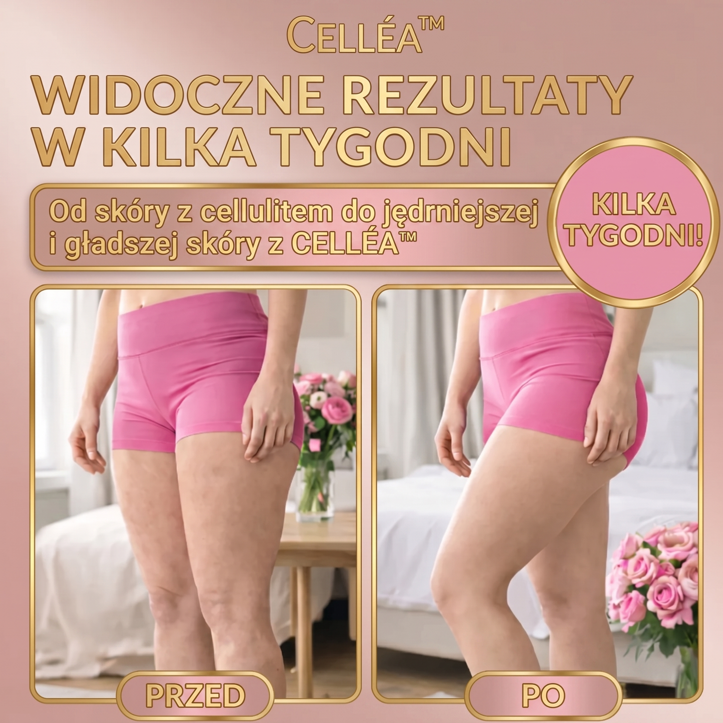 CELLÉA™ - Masażer Antycellulitowy