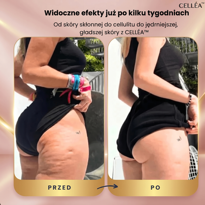 CELLÉA™ - Masażer Antycellulitowy